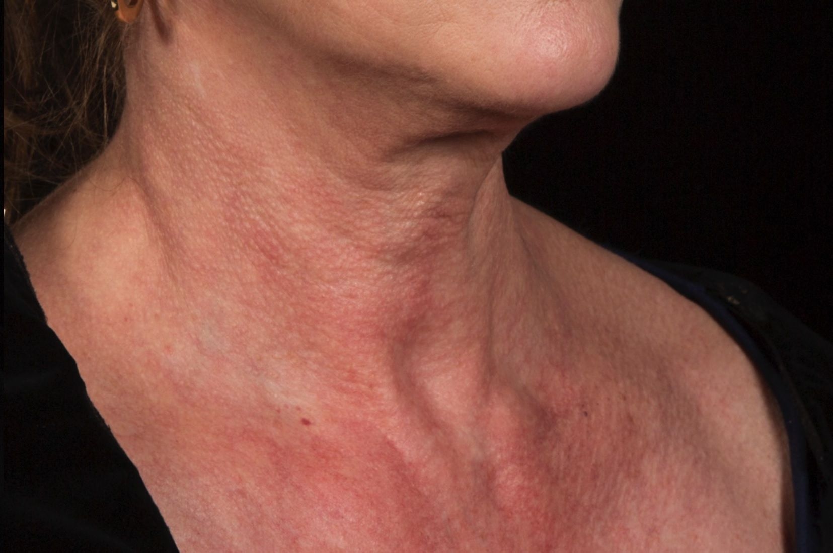 Neck After.jpg
