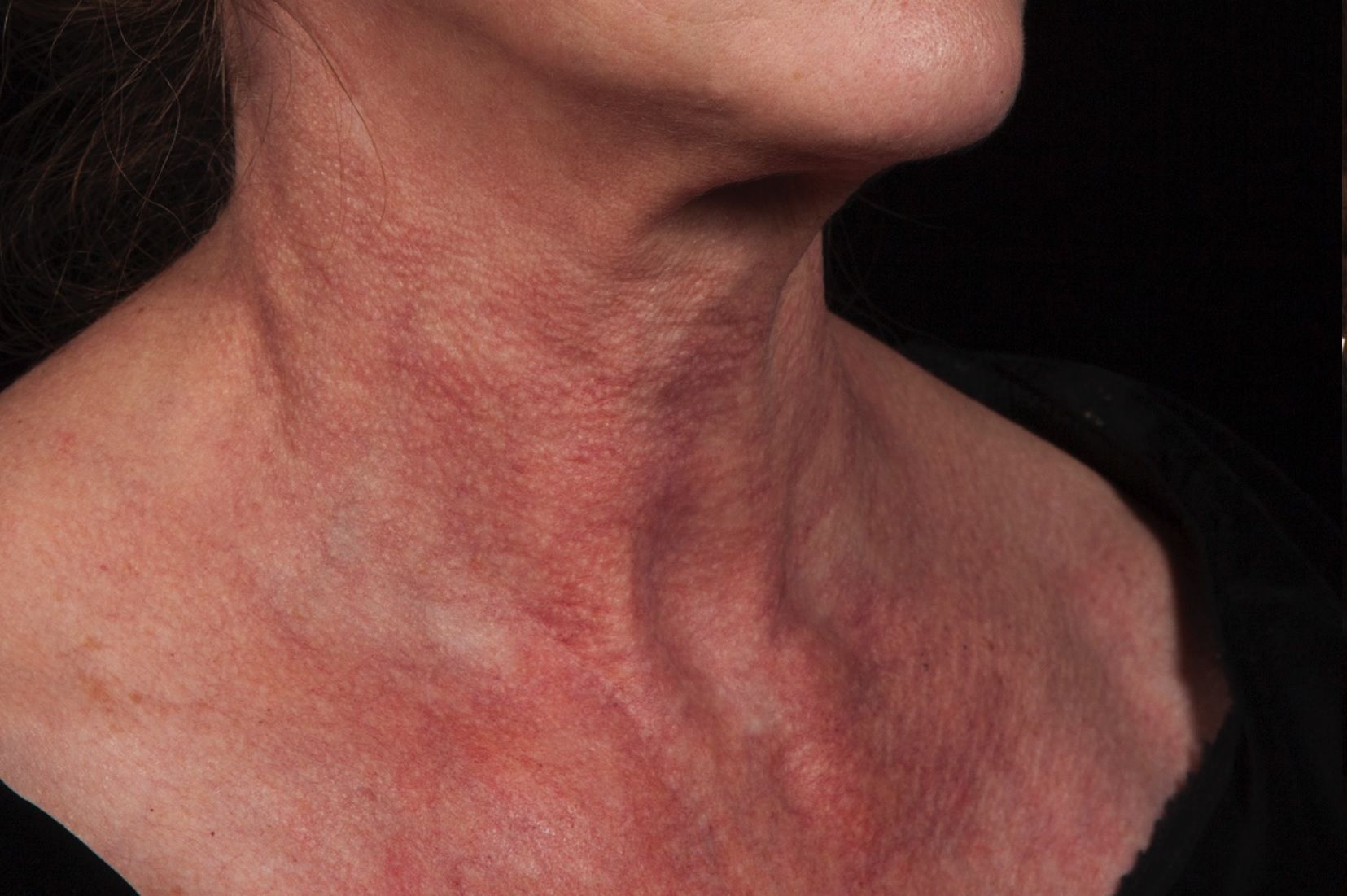 Neck Before.jpg