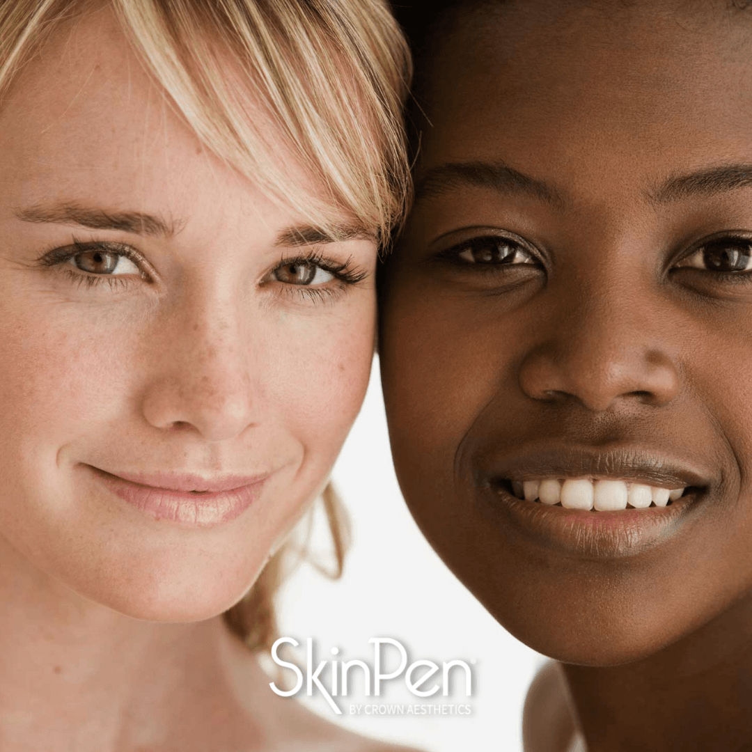Skin Pen Ladies.png