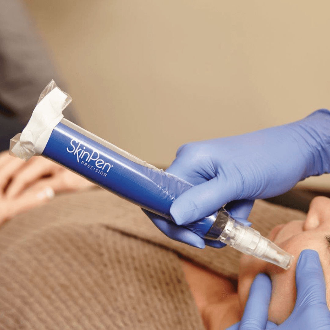 SkinPen Microneedling