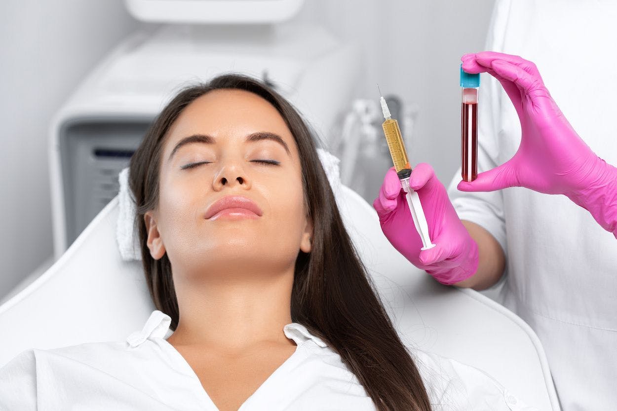 Woman getting platelet rich plasma facial with two vials showing the process 