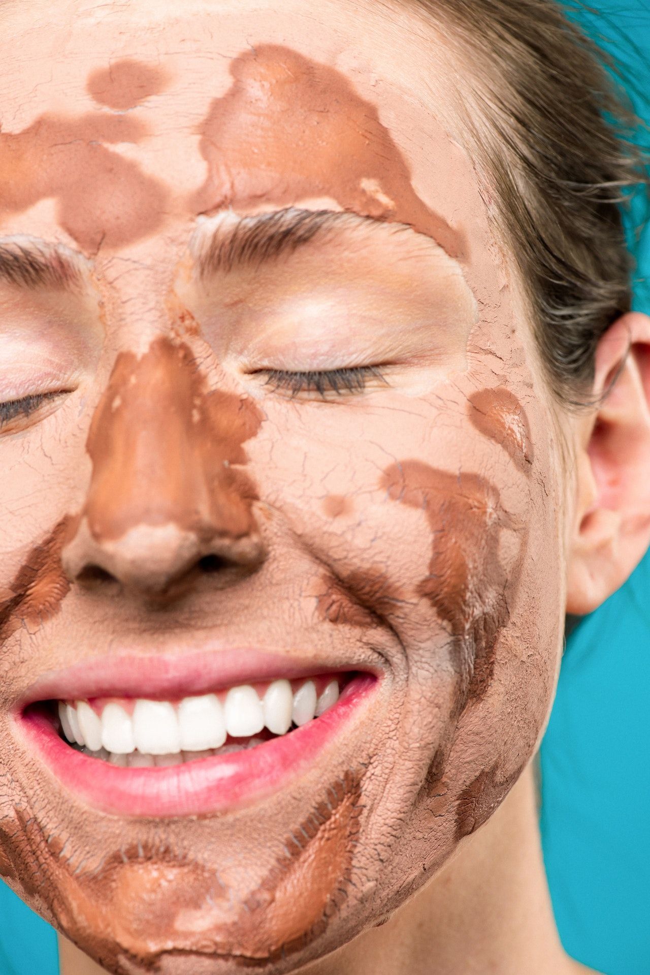 Dehydrated Skin